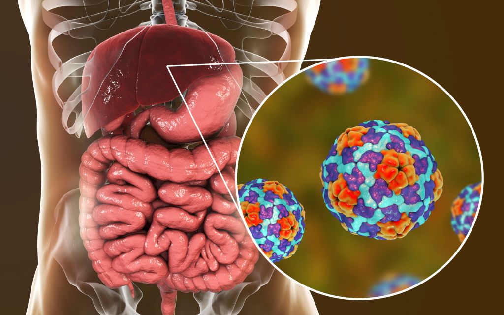 Hepatitis A infection, illustration