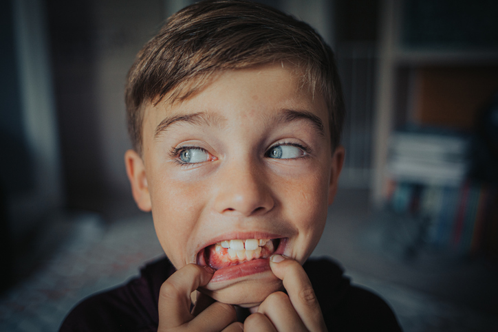 Young Caucasian Boy Showing Off Recently Lost Tooth,Lena,Illinois,United States,USA
